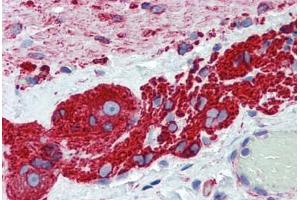 Human Small Intestine, Myenteric Plexus: Formalin-Fixed, Paraffin-Embedded (FFPE) (TUBB2A 抗体  (AA 1-446))