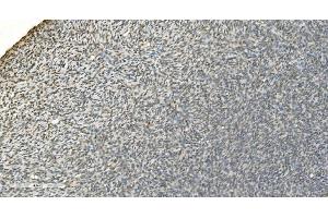 IHC analysis of LSM7 using anti-LSM7 antibody (ABIN7598937). (LSM7 抗体  (AA 1-103))