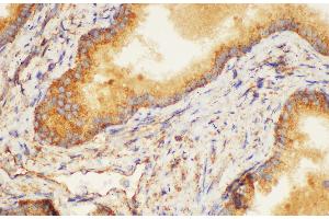 Immunohistochemistry of paraffin-embedded Human prostate using K1KB3 Ployclonal Antibody at dilution of 1:200. (KLK1B3 抗体)