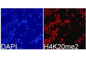 Immunofluorescence analysis of 293T cell using H4K20me2 antibody. (Histone 3 抗体  (2meLys20))