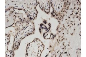 Immunoperoxidase of monoclonal antibody to BCL11A on formalin-fixed paraffin-embedded human placenta. (BCL11A 抗体  (AA 1-88))