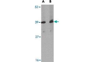 Western blot analysis of Apba1 in mouse spleen tissue lysate with Apba1 polyclonal antibody  at (A) 1 and (B) 2 ug/mL . (APBA1 抗体  (Internal Region))
