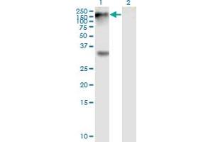 Western Blot analysis of EPHB1 expression in transfected 293T cell line by EPHB1 monoclonal antibody (M01), clone 4G6. (EPH Receptor B1 抗体  (AA 221-320))