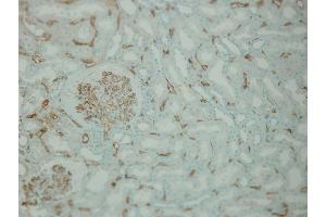 Immunohistochemistry (IHC) image for anti-Complement Component C4d (C4d) (Internal Region) antibody (ABIN870587) (Complement C4d 抗体  (Internal Region))