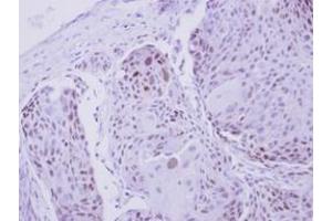 Image no. 1 for anti-Zinc Finger Protein 530 (ZNF530) (AA 1-190) antibody (ABIN1501847) (ZNF530 抗体  (AA 1-190))