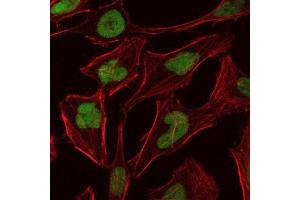 Immunofluorescence (IF) image for anti-Minichromosome Maintenance Complex Component 2 (MCM2) antibody (ABIN969281)