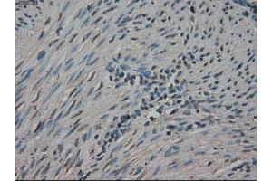 Immunohistochemical staining of paraffin-embedded Ovary tissue using anti-NEK6mouse monoclonal antibody. (NEK6 抗体)