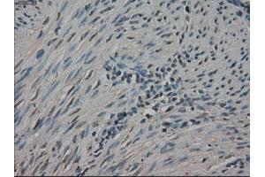 Immunohistochemical staining of paraffin-embedded Ovary tissue using anti-NEK6mouse monoclonal antibody. (NEK6 抗体)