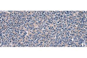 Immunohistochemistry of paraffin-embedded Human tonsil tissue using LAMP3 Polyclonal Antibody at dilution of 1:30(x200) (LAMP3 抗体)