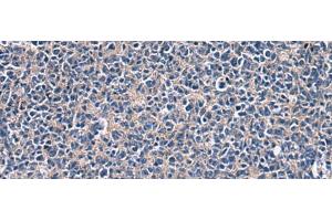 Immunohistochemistry of paraffin-embedded Human tonsil tissue using LAMP3 Polyclonal Antibody at dilution of 1:30(x200) (LAMP3 抗体)