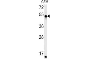 Western Blotting (WB) image for anti-FK506 Binding Protein 8, 38kDa (FKBP8) antibody (ABIN3002504) (FKBP8 抗体)