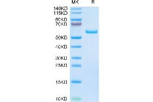Human TIMP1 on Tris-Bis PAGE under reduced condition. (TIMP1 Protein (AA 24-207) (Fc Tag))