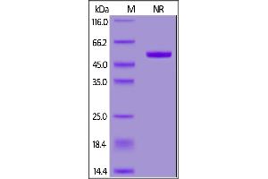 Human APRIL, His,Flag Tag, active trimer on  under ing (NR) condition. (TNFSF13 Protein (AA 111-250) (His tag,DYKDDDDK Tag))