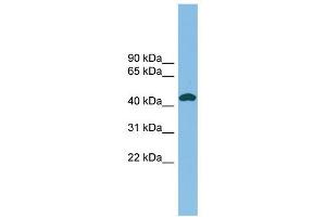 NODAL antibody used at 1 ug/ml to detect target protein. (Nodal 抗体)