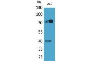 Western Blotting (WB) image for anti-Myeloproliferative Leukemia Virus Oncogene (MPL) (Internal Region) antibody (ABIN3178485) (MPL 抗体  (Internal Region))