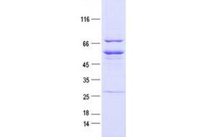 Western Blotting (WB) image for EPH Receptor B1 (EPHB1) protein (DYKDDDDK Tag) (ABIN2720246)