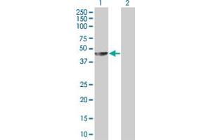 Western Blot analysis of MAGEA4 expression in transfected 293T cell line by MAGEA4 MaxPab polyclonal antibody. (MAGEA4 抗体  (AA 1-317))