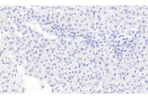 ABIN5872058 Negative Control showing staining of paraffin embedded Human Liver, with no primary antibody. (MGLL 抗体)