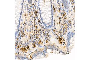 Immunohistochemistry (IHC) image for anti-Ferritin, Light Polypeptide (FTL) (AA 1-175) antibody (ABIN6140791)