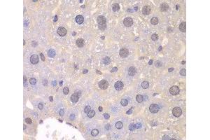 Immunohistochemistry of paraffin-embedded Mouse liver using FGFR1 Polyclonal Antibody at dilution of 1:100 (40x lens). (FGFR1 抗体)