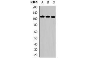 Western blot analysis of DPD expression in Hela (A), HepG2 (B), Jurkat (C) whole cell lysates. (DPYD 抗体)