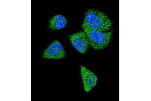 Confocal immunofluorescent analysis of C6 Antibody (N-term) (ABIN390924 and ABIN2841126) with MDA-M cell followed by Alexa Fluor® 488-conjugated goat anti-rabbit lgG (green). (C6 抗体  (N-Term))
