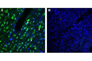 Expression of AXL in rat parietal cortex. (AXL 抗体  (Extracellular))
