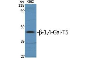 Western Blot (WB) analysis of specific cells using beta-1,4-Gal-T5 Polyclonal Antibody. (B4GALT5 抗体  (C-Term))