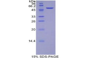 SDS-PAGE analysis of Rat TFAM Protein. (TFAM 蛋白)