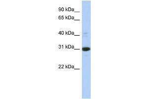 WB Suggested Anti-IMPA1 Antibody Titration: 0. (IMPA1 抗体  (Middle Region))