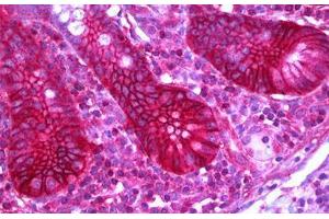 Immunohistochemistry (IHC) image for anti-Solute Carrier Family 12 (Potassium-Chloride Transporter) Member 2 (SLC12A2) (AA 903-1010) antibody (ABIN961557)