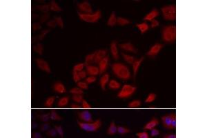Immunofluorescence analysis of U2OS cells using PIKFYVE Polyclonal Antibody (PIKFYVE 抗体)