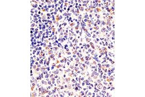 (ABIN6243124 and ABIN6578087) staining DPYSL5 in human tonsil sections by Immunohistochemistry (IHC-P - paraformaldehyde-fixed, paraffin-embedded sections). (DPYSL5 抗体  (C-Term))
