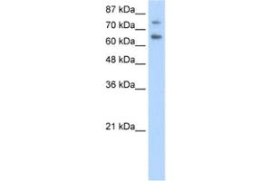 Western Blotting (WB) image for anti-Zinc Finger and SCAN Domain Containing 2 (ZSCAN2) antibody (ABIN2462016)