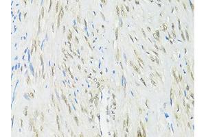Immunohistochemistry of paraffin-embedded human uterus using RBFOX3 antibody (ABIN1874561) at dilution of 1:100 (40x lens). (NeuN 抗体)