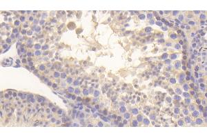 Immunohistochemistry (IHC) image for anti-Macrophage Migration Inhibitory Factor (Glycosylation-Inhibiting Factor) (MIF) antibody (ABIN7432418)