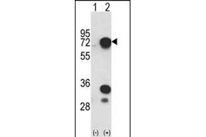 Western blot analysis of HNRPL (arrow) using rabbit polyclonal HNRPL Antibody (C-term) (ABIN650773 and ABIN2839553). (HNRNPL 抗体  (C-Term))