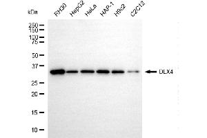 anti-Distal-Less Homeobox 4 (DLX4) antibody