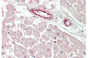 Rabbit Anti-KCNIP2 antibody  Formalin Fixed Paraffin Embedded Tissue: Human Heart Primary antibody Concentration: 1:100 Secondary Antibody: Donkey anti-Rabbit-Cy3 Secondary Antibody Concentration: 1:200 Magnification: 20x Exposure Time: 0. (KCNIP2 抗体  (N-Term))