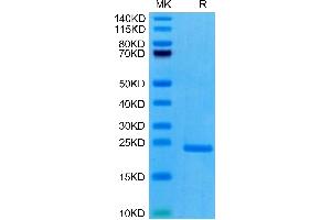 Human PRL-3 on Tris-Bis PAGE under reduced condition. (PTP4A3 Protein (AA 1-170) (His tag))