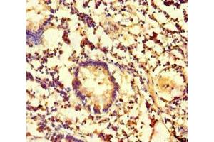 Immunohistochemistry of paraffin-embedded human appendix tissue using ABIN7146751 at dilution of 1:100 (CES3 抗体  (AA 65-233))