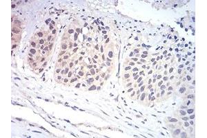 anti-14-3-3 alpha + beta (YWHAB) (AA 1-246) antibody