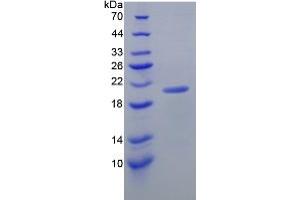 SDS-PAGE analysis of Mouse Interleukin 17C Protein. (IL17C 蛋白)