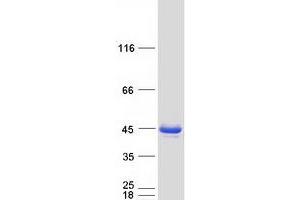Western Blotting (WB) image for Mitochondrial Trans-2-Enoyl-CoA Reductase (MECR) (Transcript Variant 1) protein (Myc-DYKDDDDK Tag) (ABIN2725726)