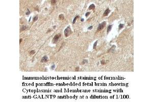 Image no. 1 for anti-Udp-N-Acetyl-alpha-D-Galactosamine:polypeptide N-Acetylgalactosaminyltransferase 9 (GalNAc-T9) (GALNT9) antibody (ABIN791210) (GALNT9 抗体)