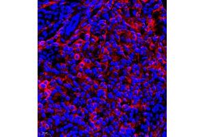 Immunofluorescence of paraffin embedded mouse ovary using CRMP3 (ABIN7073734) at dilution of 1:650 (400x lens)