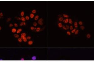 Immunofluorescence analysis of MCF7 cells using Phospho-POLR2A(S5) Polyclonal Antibody at dilution of 1:100. (POLR2A/RPB1 抗体  (pSer5))