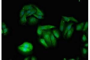 Immunofluorescent analysis of HepG2 cells using ABIN7174076 at dilution of 1:100 and Alexa Fluor 488-congugated AffiniPure Goat Anti-Rabbit IgG(H+L) (TXK 抗体  (AA 32-83))