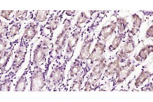 Paraformaldehyde-fixed, paraffin embedded Human stomach, Antigen retrieval by boiling in sodium citrate buffer (pH6.