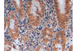 Immunohistochemistry (IHC) image for anti-O6-Methylguanine-DNA-Methyltransferase (MGMT) (AA 1-207) antibody (ABIN7434551)